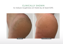 Load image into Gallery viewer, Glytone AHA+ Ultra Softening Foot Cream