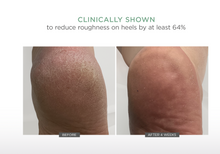 Load image into Gallery viewer, Glytone AHA+ Ultra Softening Foot Cream