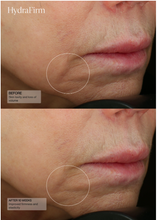 Load image into Gallery viewer, SENTÉ® HydraFirm (Dermal Contour Pressed Serum)