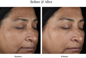 Skin Medica LUMIVIVE® System