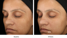 Load image into Gallery viewer, Skin Medica LUMIVIVE® System
