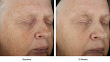 Load image into Gallery viewer, Skin Medica LUMIVIVE® System
