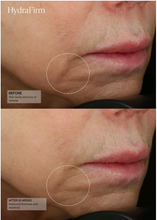 Load image into Gallery viewer, SENTÉ® HydraFirm (Dermal Contour Pressed Serum)
